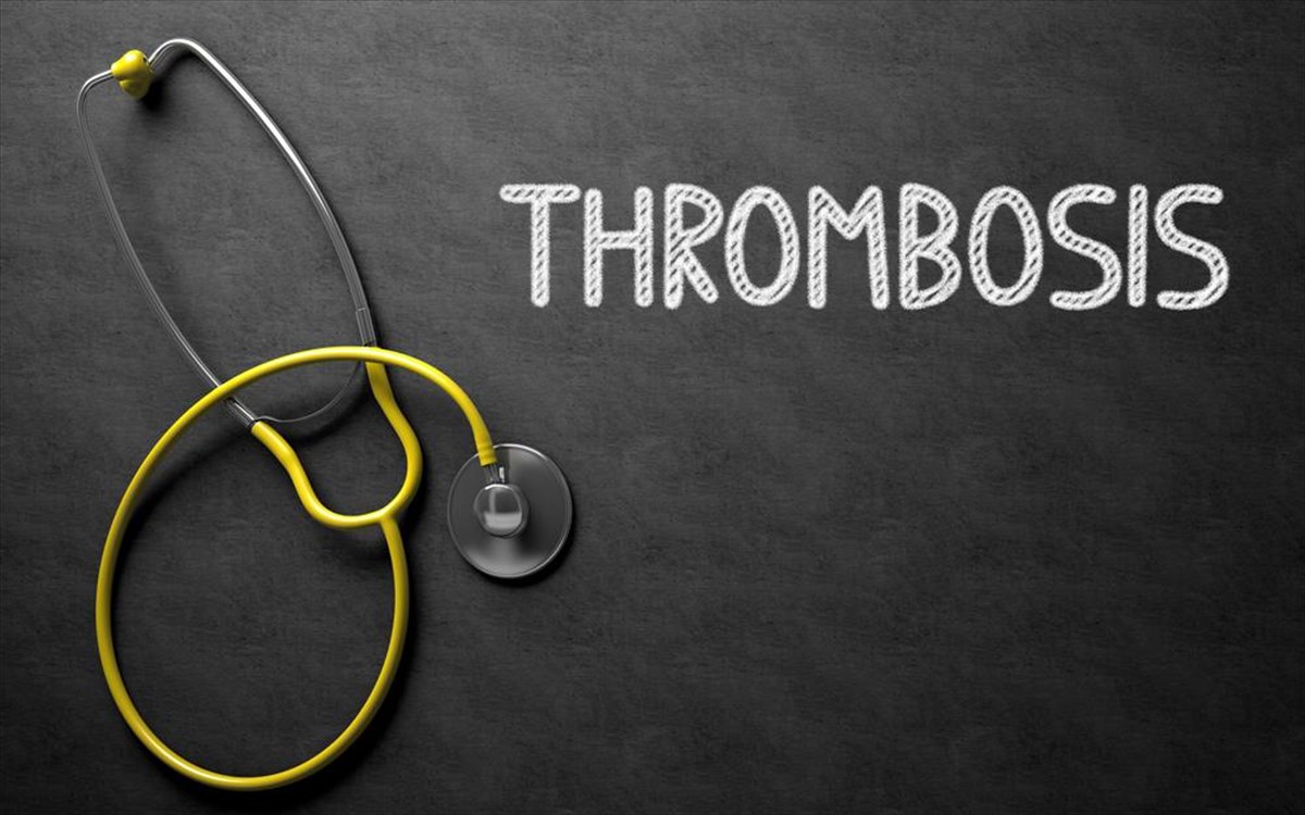 thrombosi