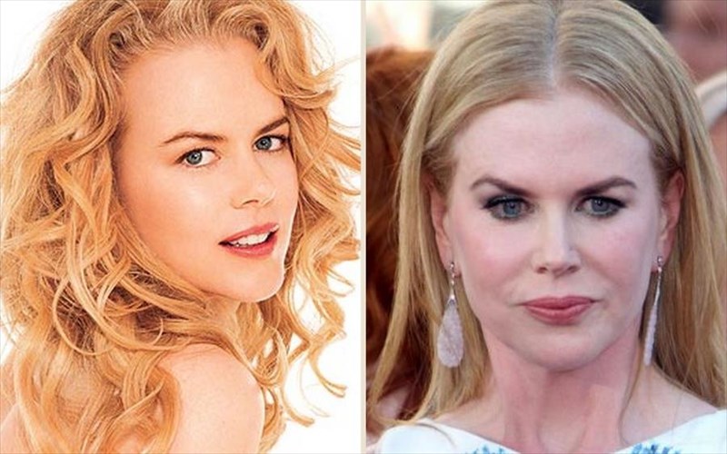 giati-metanionei-simera-i-nicole-kidman-nicole-kidman
