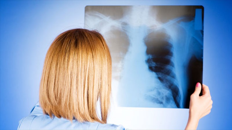 i-radienergeia-kanei-kalo-sumfona-me-orismenous-airetikous-epistimones