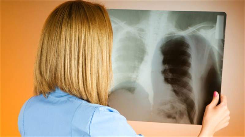 karkinos-tou-pneumona-proti-aitia-thanatou-pagkosmios