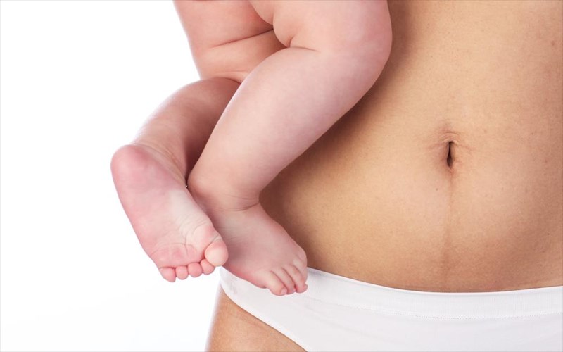 mommy-makeover-koilioplastiki-kai-anorthosi-stithous