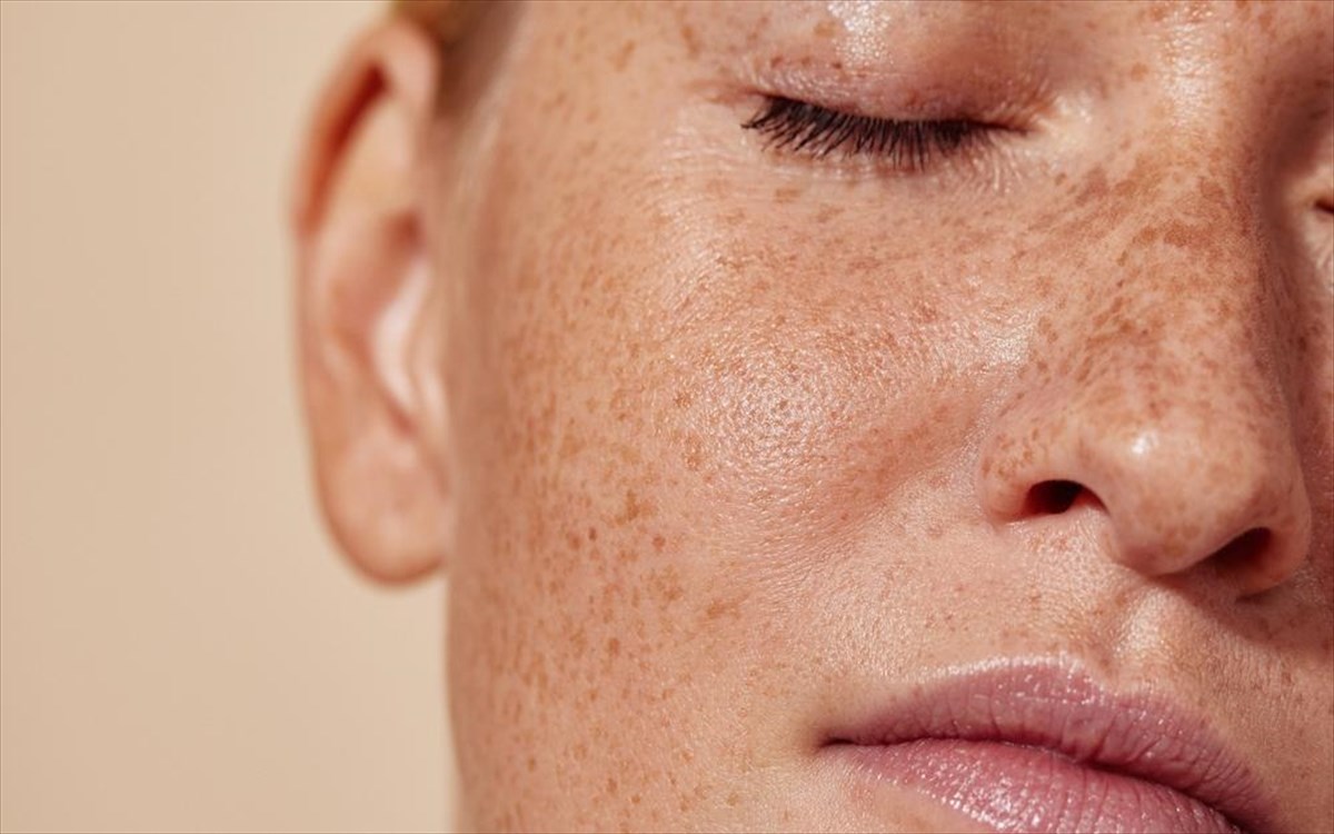 derma-gunaika-fakides