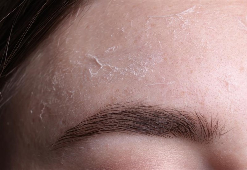 ti-prospathei-na-sas-pei-to-derma-sas-meta-tis-giortes-anagnoriste-ta-simadia