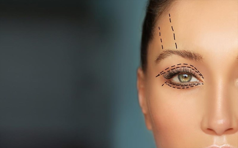 blefaroplastiki-apo-tin-ilikia-mexri-tin-anarrosi-ti-prepei-na-gnorizete