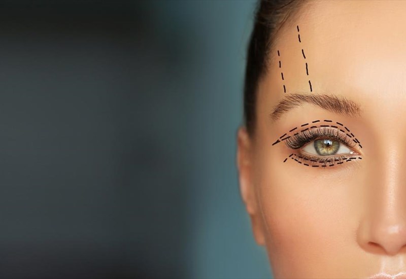 blefaroplastiki-apo-tin-ilikia-mexri-tin-anarrosi-ti-prepei-na-gnorizete