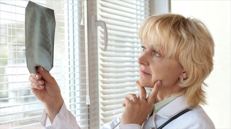 xronia-apofraktiki-pneumonopatheia-mia-siopili-astheneia