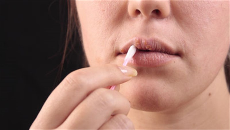 epixeilios-erpis-giati-dimiourgeitai-kai-pos-antimetopizetai