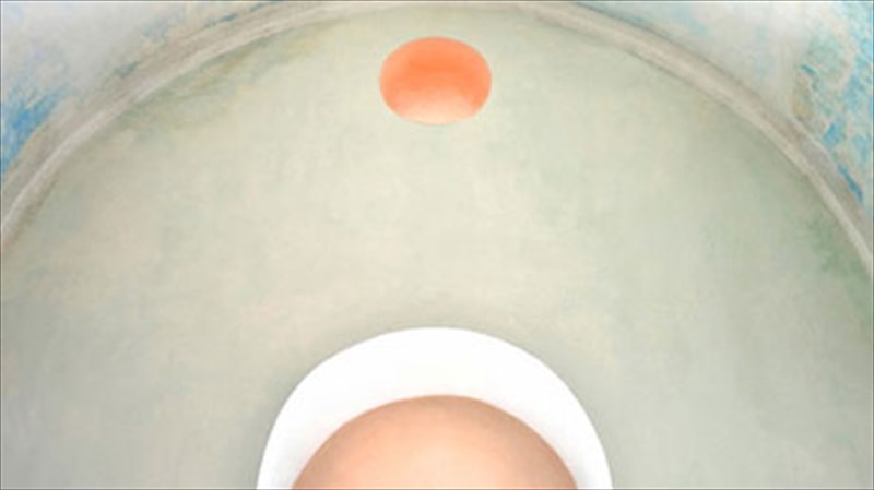 ti-krubetai-pera-apo-to-leuko