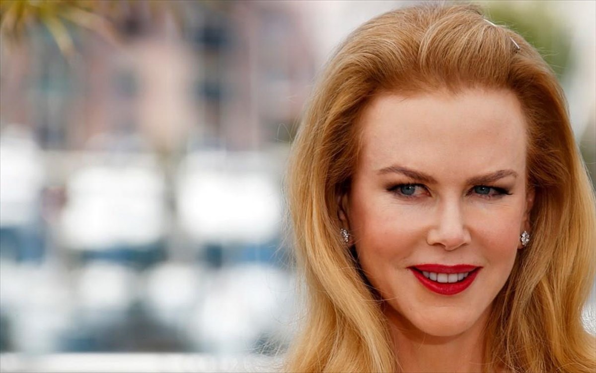 nicole-kidman-botox