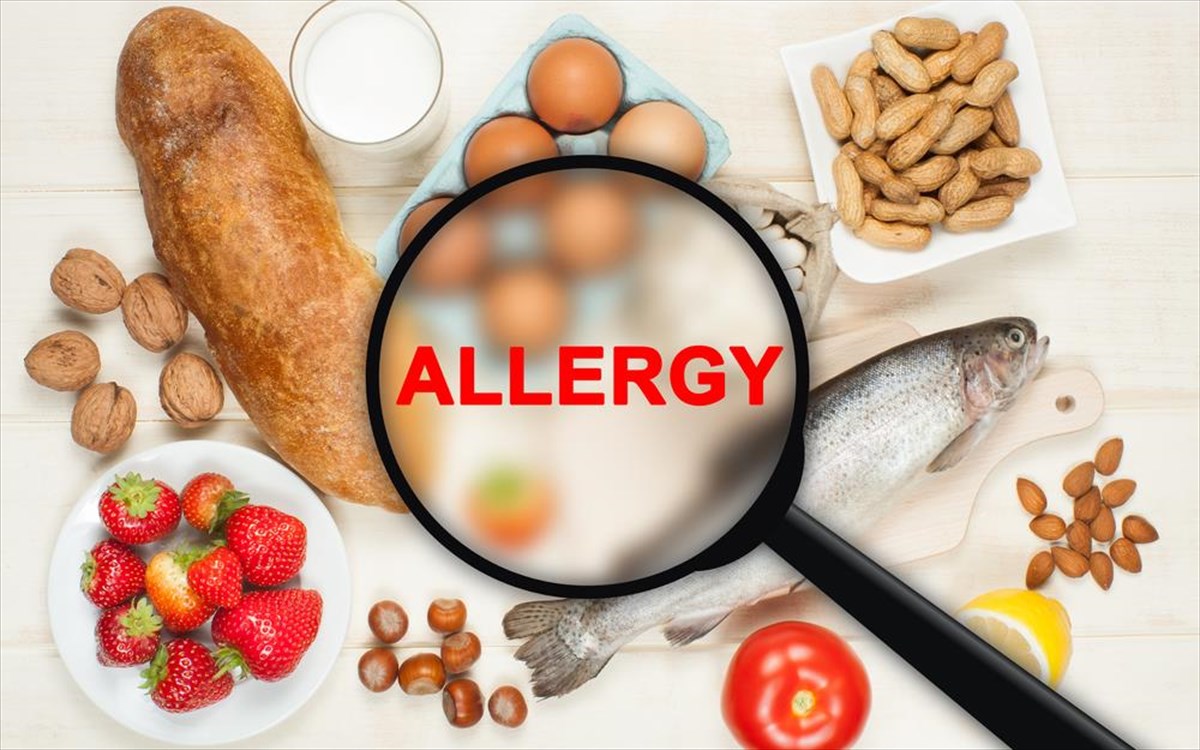 trofiki-allergia